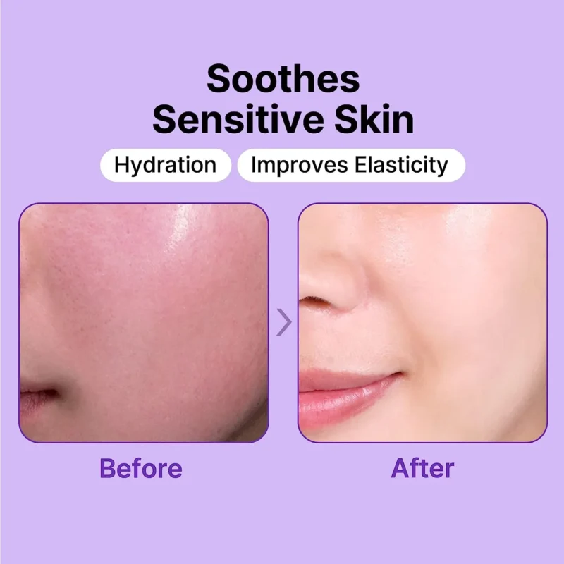 Tiam Snail & Azulene Water Essence